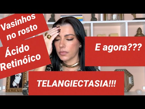 ÁCIDO RETINÓICO E SEUS PROBLEMAS!!!