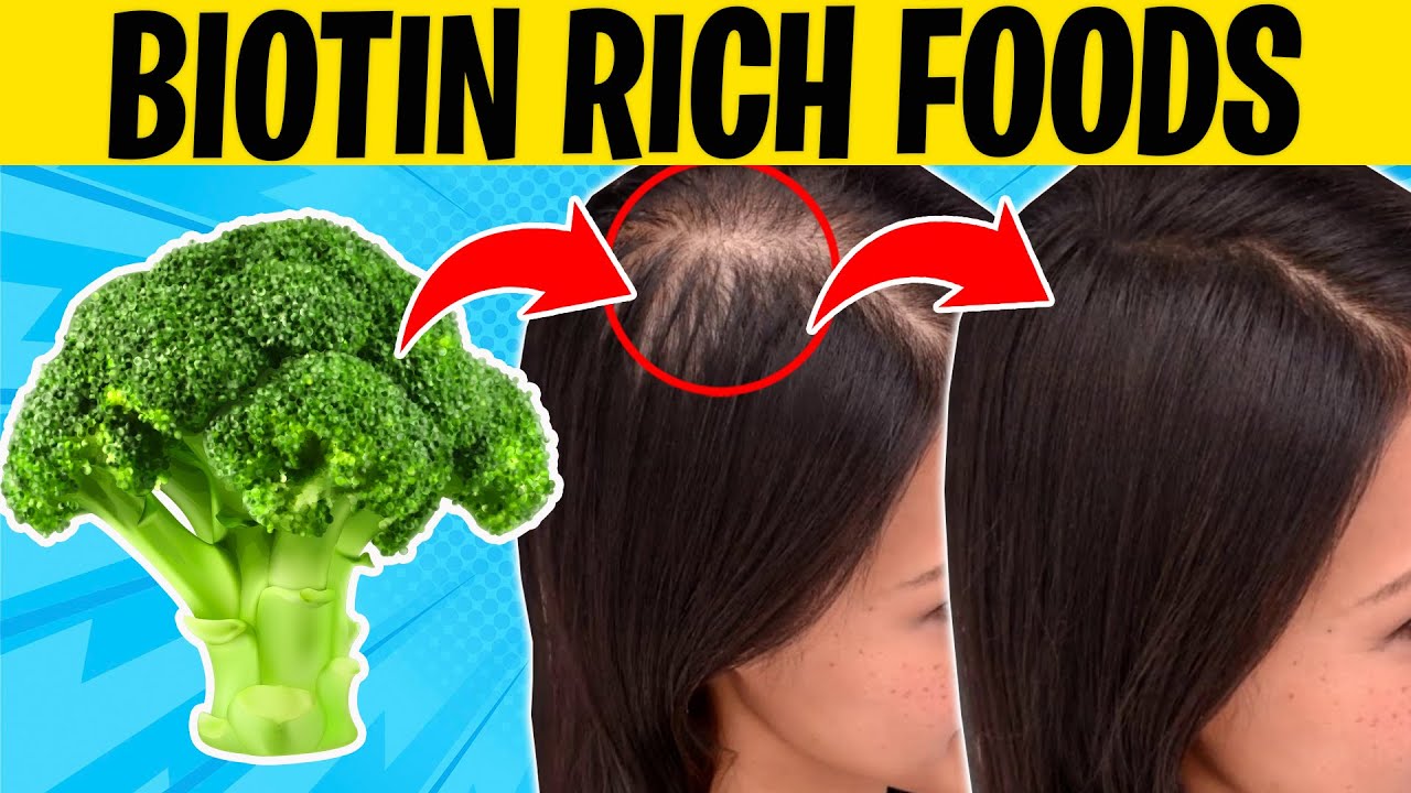 Top 5 Biotin Rich Foods For MASSIVE Hair Growth