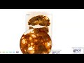 Polycystic Kidney Disease Concepts