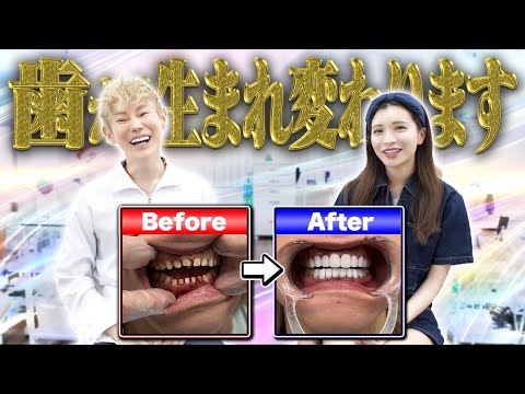 【初公開】私の歯について全て話します。