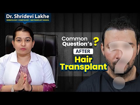 Commonly Asked After Hair Transplant Questions Answered By Dr. Shridevi Lakhe #hairtransplant