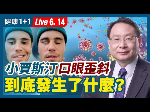 小賈斯汀口眼歪斜面癱，到底發生了什麼？有人猜測因為新冠疫苗副作用嗎？疫苗、病毒造成的損傷，如何救治？5大維生素小兵立大功！減少人體的炎症反應的方法？（6.14.2022）| 健康1+1 · 直播