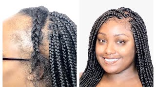 Box Braids For Thinning Hair Videos Kansas City Comic Con