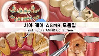 ASMR 치아케어 애니메이션 모음집 충치,사랑니,치아교정,편도결석, 치석제거 TEETH ANIMATION COLLECTION Cavities,tonsil stones,tartar