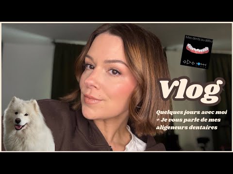 VLOG : Je vous parle de mes aligneurs dentaires