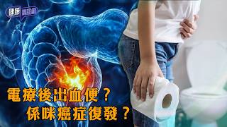 電療後出血便？係咪癌症復發？ ｜ 健康關注組 ｜ EP578 ｜ 放射性直腸炎 ｜ 血便 ｜ 盆腔電療 ｜ 癌症復發 ｜ 黃芳雯 ｜ 朱智賢 ｜ HOY