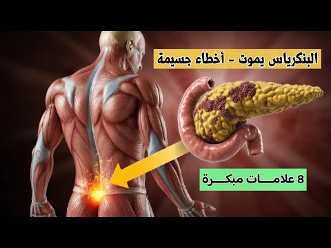 8 علامات مبكره تدل على سرطان البنكرياس‼️|معظمها بتحصلنا يوميا😳