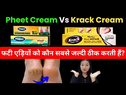 Best Crack heel Cream || Pheet Cream Vs Krack Cream दोनों में से बेस्ट क्रीम कौनसी है?