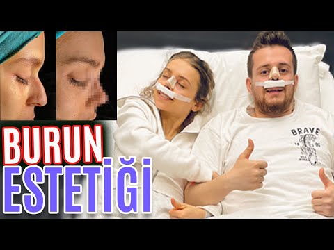 BURUN AMELİYATI OLDUK! (Sevgilim benim için burun ameliyatı oldu) @AlperRENDE