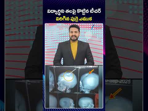 6th Class Girl Student Suffer Skull Fracture, Teacher Whacked School Bag on her Head In Punganur|ZEE