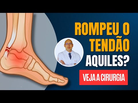 Rompeu o Tendão de Aquiles? Saiba Tudo Sobre a Cirurgia!