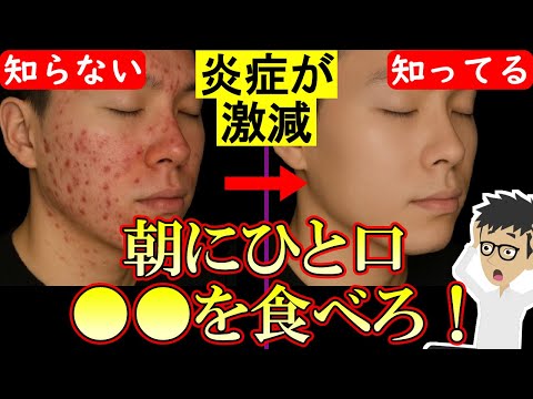 【最新研究】全身の炎症を強力に抑える食べ物TOP4！ニキビや肌荒れに効果的！【老化防止｜アンチエイジング｜老いる】
