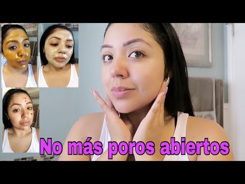 Cómo eliminar los Poros Abiertos Para siempre/ trucos de Belleza