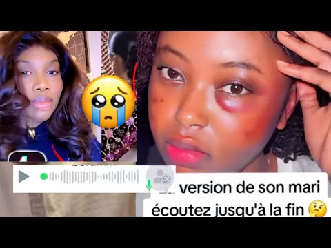 ROX  EN DIRECT aprés la sortie de Diarra et Saliou