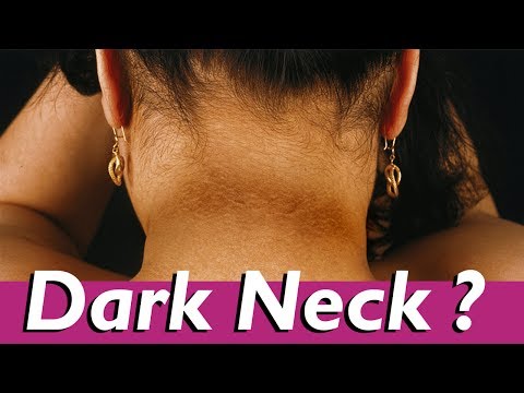 Tips to remove Neck Black - Effective Home Remedies To Get Rid Of A Dark Neck - Beauty Tips in Tamil