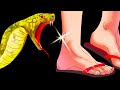 Kuis: Gigitan Ular dan Efeknya