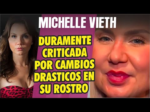 Michelle Vieth duramente criticada por cambios drásticos en su rostro