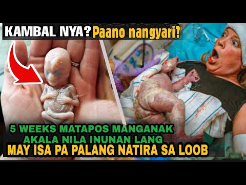 5 Weeks matapos manganak, ito ang natuklasan ng mga doctor may isa pang natira sa loob | True Story