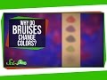 Understanding Bruises and Their Color Changes