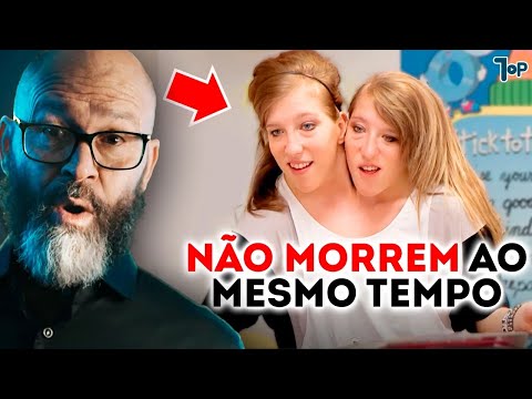 O que acontece se um gêmeo siamês morrer e o outro continuar vivendo?