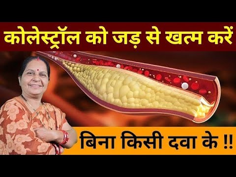 कोलेस्ट्रॉल के लिए रामबाण घरेलु इलाज | 8 Most Effective Home Remedies For Cholesterol