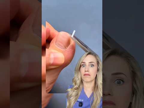 Could this fix an ingrown toenail?!