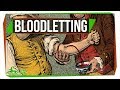 Understanding Bloodletting and Phlebotomy