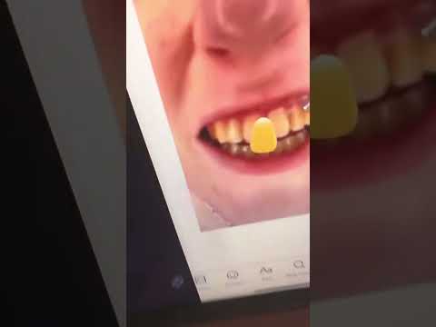 EAT YOU TOOTHPASTE #relatable #crazy #funny #shorts #fyp #laugh #ZestyTeeth#eatyourvegetables