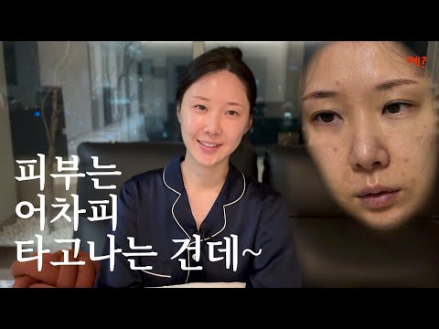 피부 안 좋은 부모 밑에서 좋은 피부 되는 법