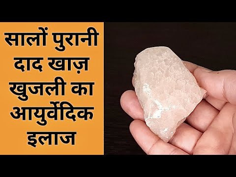 1 बार लगाएं सालों पुरानी दाद खाज़ खुजली का आयुर्वेदिक इलाज Daad Khaj Khujli ka ilaj Fungal Infection