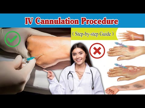 IV Cannulation Techniques | #ivcannulation Procedure