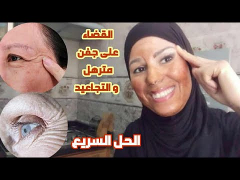 الحل السريع لشد منطقة حول العين و رفعها+ شد ترهل الجفون بدون جراحة ولا تكاليف🤑 face exercises
