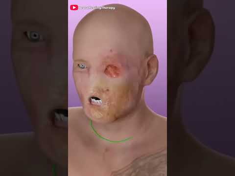 Facial Transplant 3D Animation #shorts