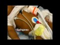 Patient Medical Condition Assessment