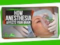 Understanding General Anesthesia