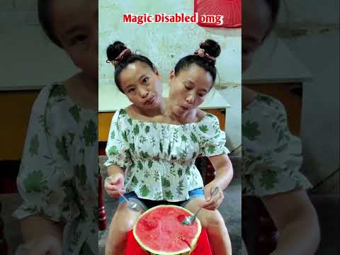Tasbih song | conjoined twins sister omg | new tiktok video#godblessyou#shorts#viralshorts#newtiktok