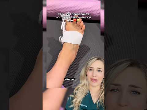 Doctor reacts: bunion treatment