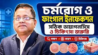 চর্মরোগ ও ফাংগাল ইনফেকশন বেড়ে চলেছে সঠিক ডায়াগনসিস ও চিকিৎসা জরুরি