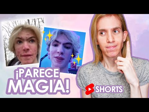 LA SOLUCIÓN para el ACNE - #shorts