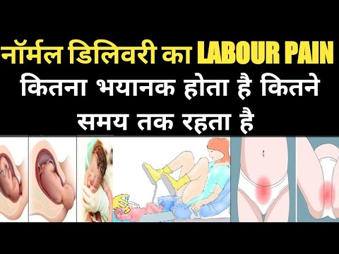 डिलीवरी रूम के अंदर क्या-क्या होता है secret बातें।  delivery room secrets tips