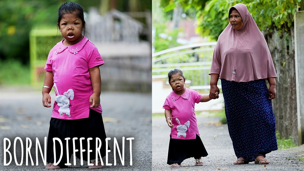 I'm 26 - and trapped in a toddler's body - born different