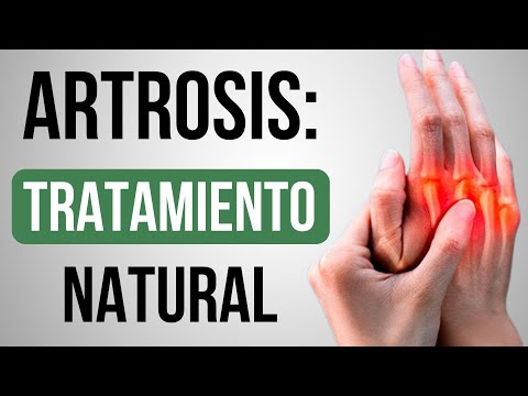 ¿Cómo COMBATIR la Artrosis?🤔Consejos y Recomendaciones🌿✅ - Dra. Susana Benito