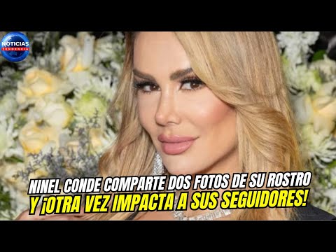 Ninel Conde comparte dos fotos de su rostro y ¡otra vez impacta a sus seguidores!