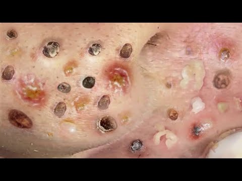 Most Satisfying and Relaxation with An Spa Video #2289