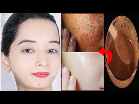 Remove Sun-Tan Instantly : ये Remedy जिद्दी से जिद्दी Sun Tan को 15 मिनट में गायब कर देगी💕