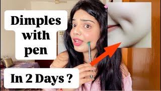 Get Dimples Naturally in 2 Days with Pen | beauty’s crown