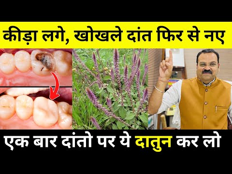 दांत में दर्द, दांत में लगा कीड़ा, खोखला दांत फिर से नए जैसा | Remedy For Tooth Cavity | Dr Bhushan