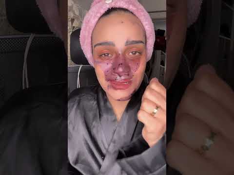 ماسك موف من 3 مكونات ف بيتك هيشيل سيئات وشك😅