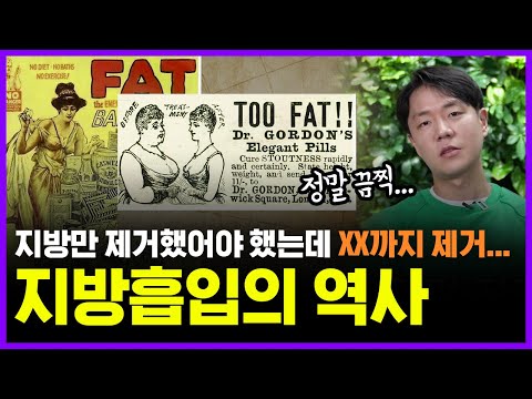 날씬해 지기 위해 누웠던 수술대, 깨어보니 상상도 못했던 곳이…!?@& | 놀라운 지방 흡입의 역사