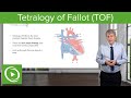 Tetralogy of Fallot Concepts